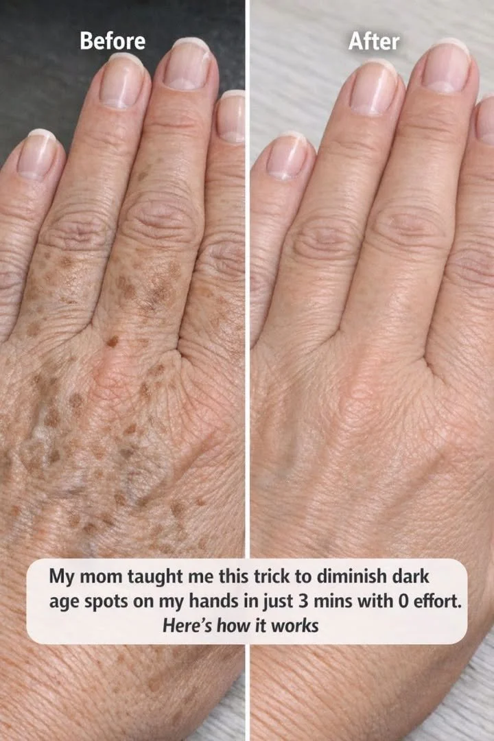 Diminish Dark Age Spots on Hands in 3 Minutes 1 Before and after treatment of dark age spots on hands