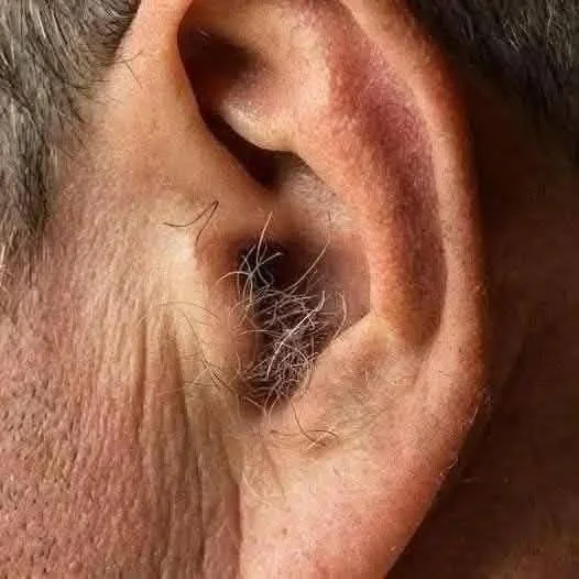 How the Body Affects Ear Hair Growth 1 Illustration of factors influencing ear hair growth in the human body