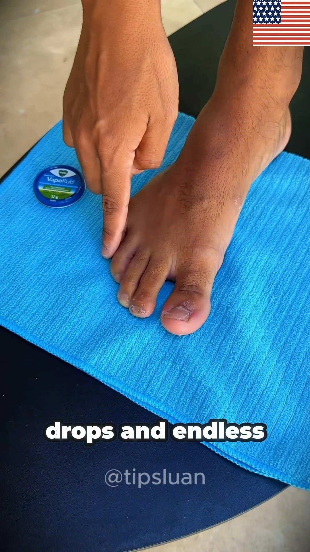 Nail Fungus Treatment: Try the Vicks Technique 1 Nail fungus treatment with Vicks technique for healthier nails