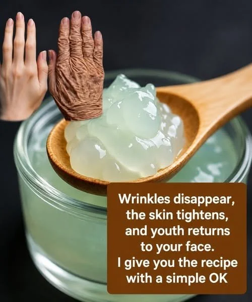 Wrinkles Disappear with Skin Tightening for a Youthful Face 1 Before and after skin tightening treatment for a youthful face